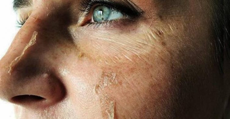 Какие бьюти-процедуры нельзя делать самостоятельно и почему