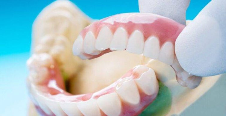 Имплантация vs. Протезирование: Что выбрать? | Клиника в Минске