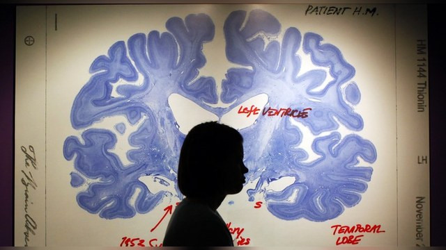 BBC: Российский миллионер ищет бессмертие в загрузке мозга на компьютер