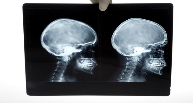 Почему Наполеон не смог завоевать Россию в 1812 году