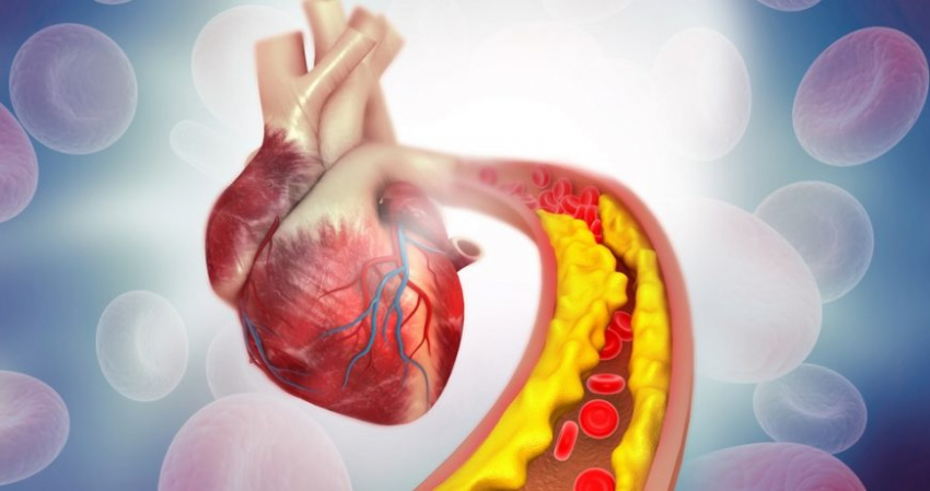 Какая диета ведет к снижению холестерина и веса: ученые из Австралии дали ответ
