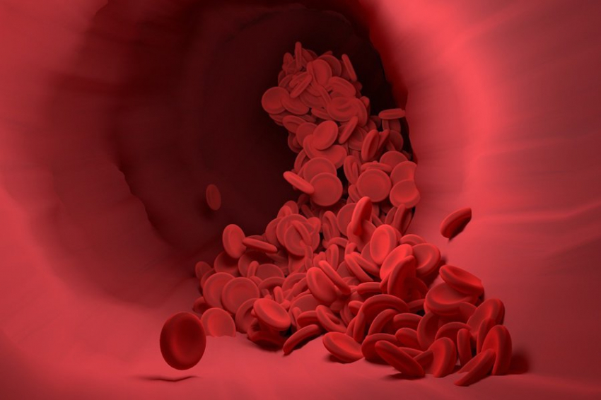 NUS: частицы, содержащиеся в красных кровяных клетках, могут смягчить атеросклероз