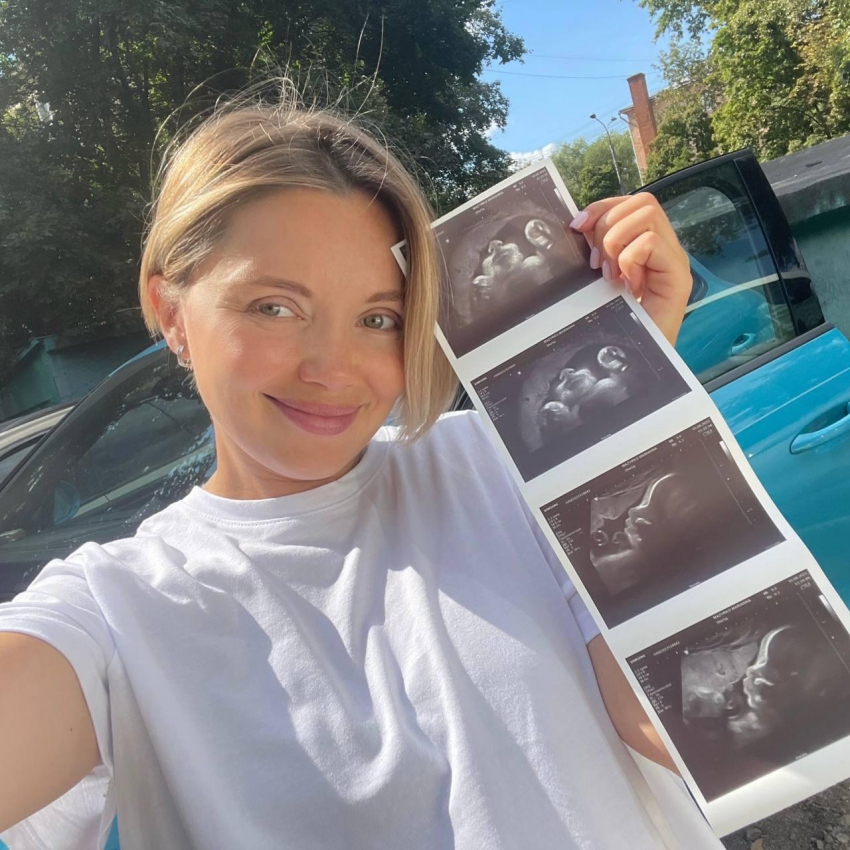 Звезда «Чебурашки» раскрыла пол будущего ребенка