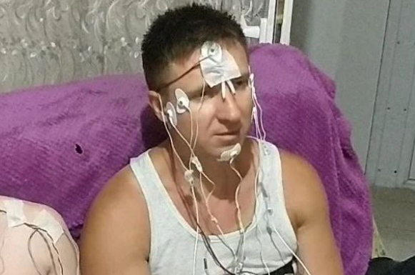 Просверливший себе голову житель Новосибирска решился на новый эксперимент