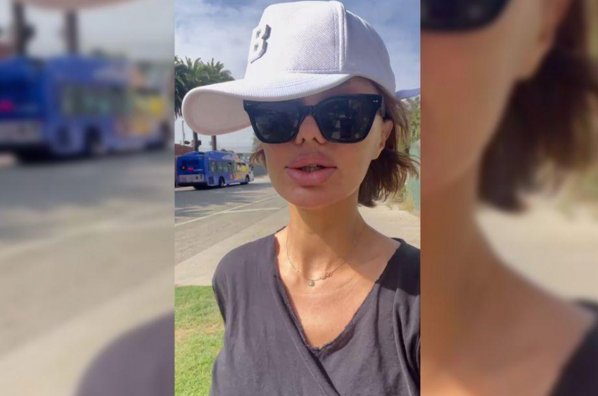 У Виктории Бони после пластики пропала чувствительность верхней губы