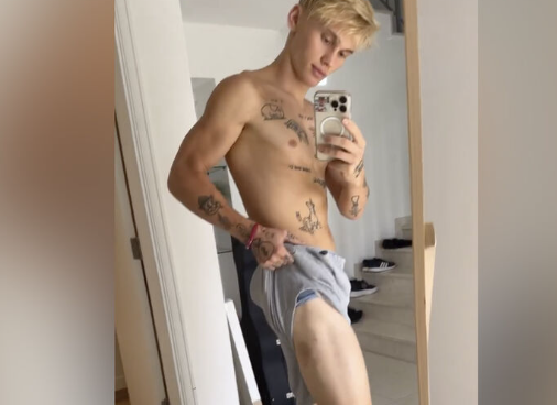 Даня Милохин на фоне новости об избиении в Тбилиси показал синяк