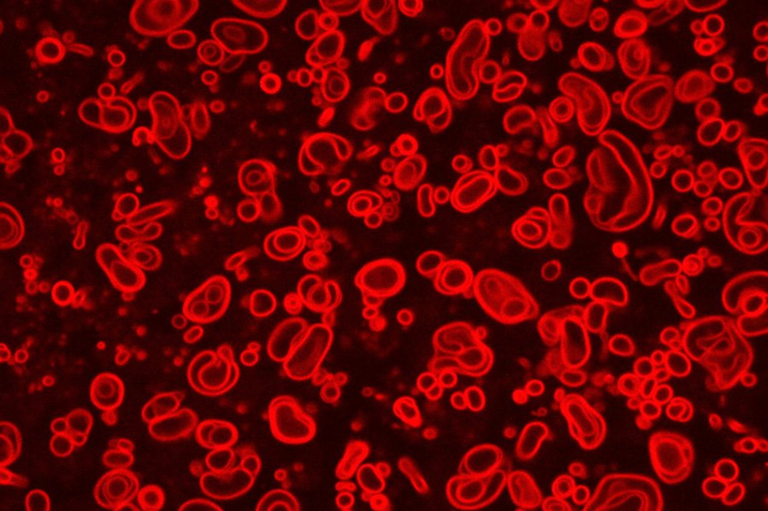 Созданные в лаборатории «протоклетки» помогают понять, как возникла жизнь